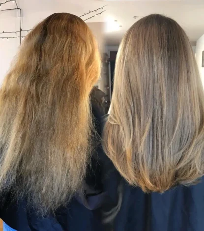 What Is the Best Hair Treatment for Dry Hair?